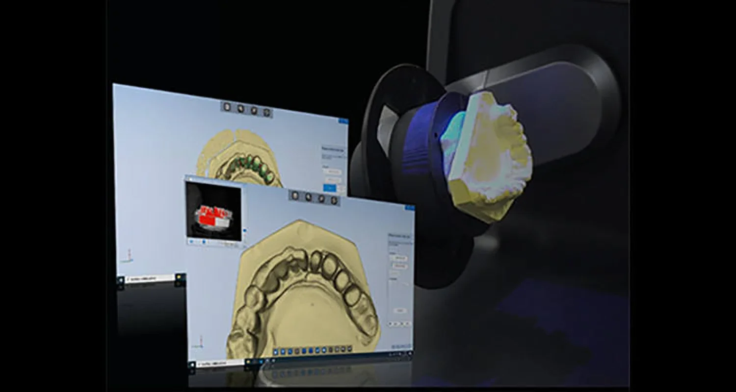 SHINNING DS-MIX 3d Scanner Handheld 3d Scanning Machine For SDT-DSMIX 3d Printer For Scanning Earmolds Hearing Aid