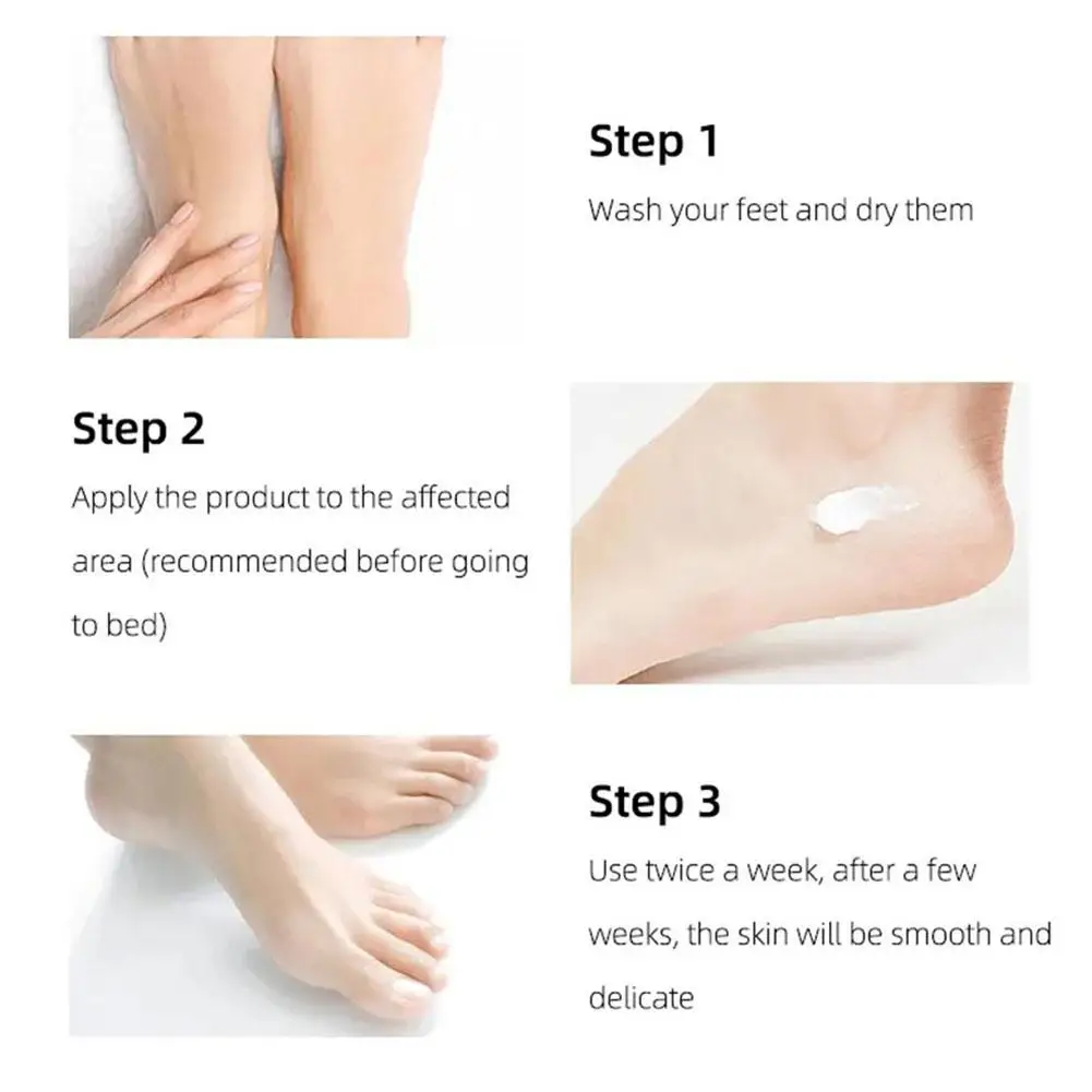 40% Foot Urea Cream Foot Peeling Spray Scrub Exfoliating Cream Heel Cracked Repair Cream Removal Dead Skin Hand Feet Care