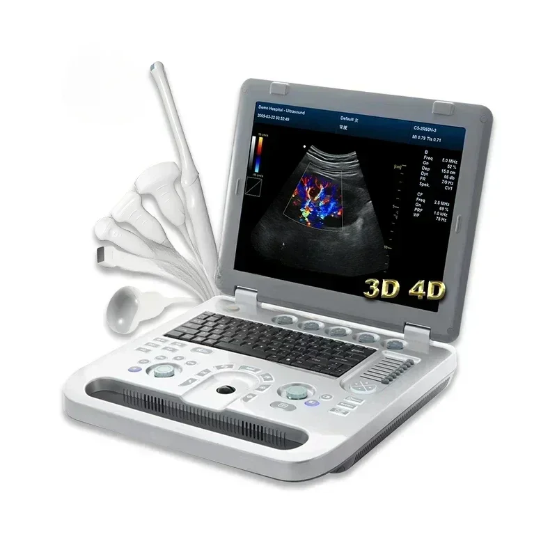 CE 3d 4d Ecografo Color Doppler Cardiac Ultrasound Machine Like Mindray with factory price