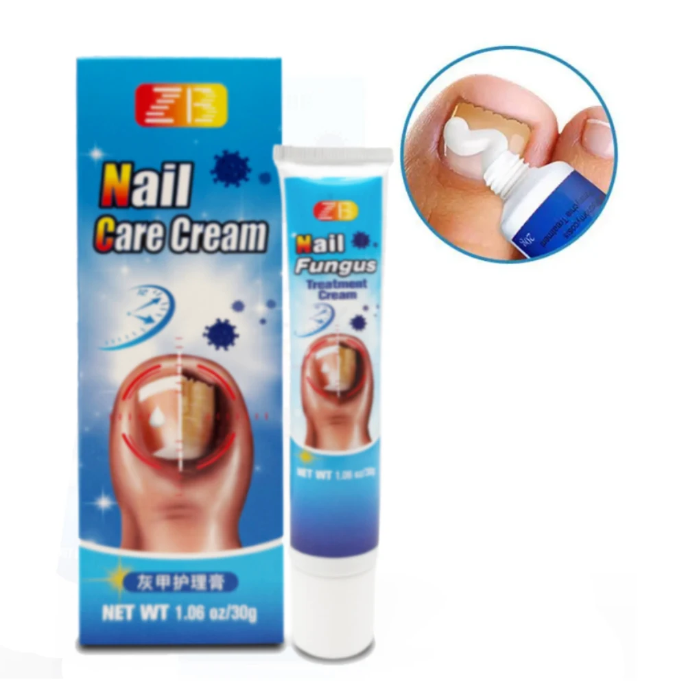 30g Nail Fungus Ointment Fungal Infection Nails Cream Feet Anti Removal Onychomycosis Paronychia Toe Repair Essence Herbal Cream - view 5