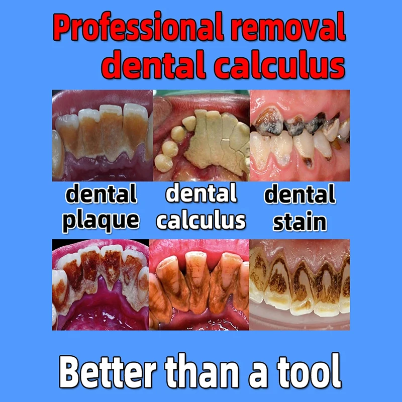 Removedor de cálculo Dental, blanqueamiento de dientes, eliminación de olores bucales, mal aliento, prevención de Periodontitis, aliento fresco, pasta de dientes para el cuidado bucal