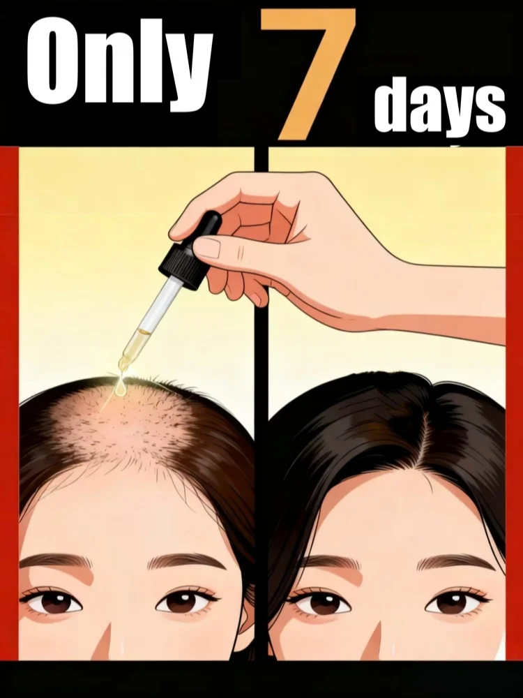 قل وداعًا لمشاكل "الهندباء" في عام 2025، تغذية الرأس، أدوات العناية ببصق الشعر