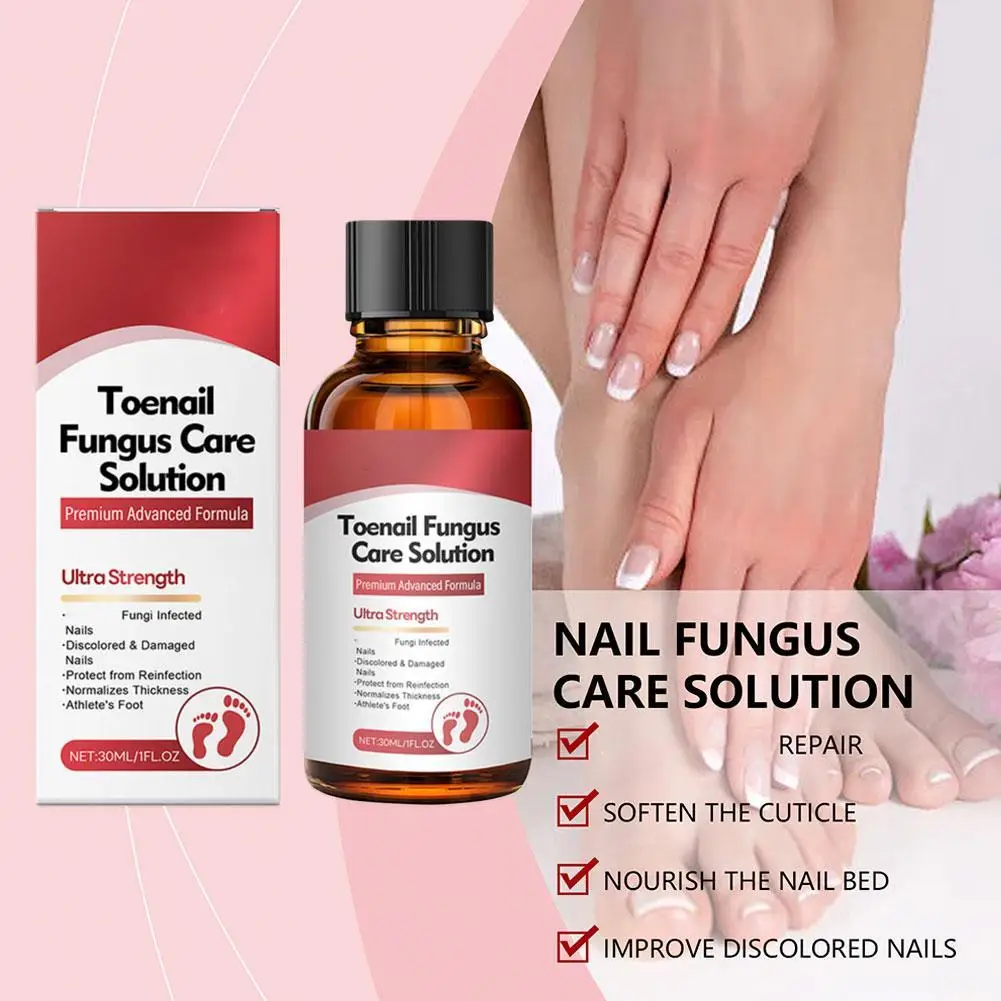 Solución de reparación de hongos en las uñas de los pies, crema líquida para eliminación de hongos en las uñas, infección, anti onicomicosis, Paroniquia fúngica en las uñas, 30ml