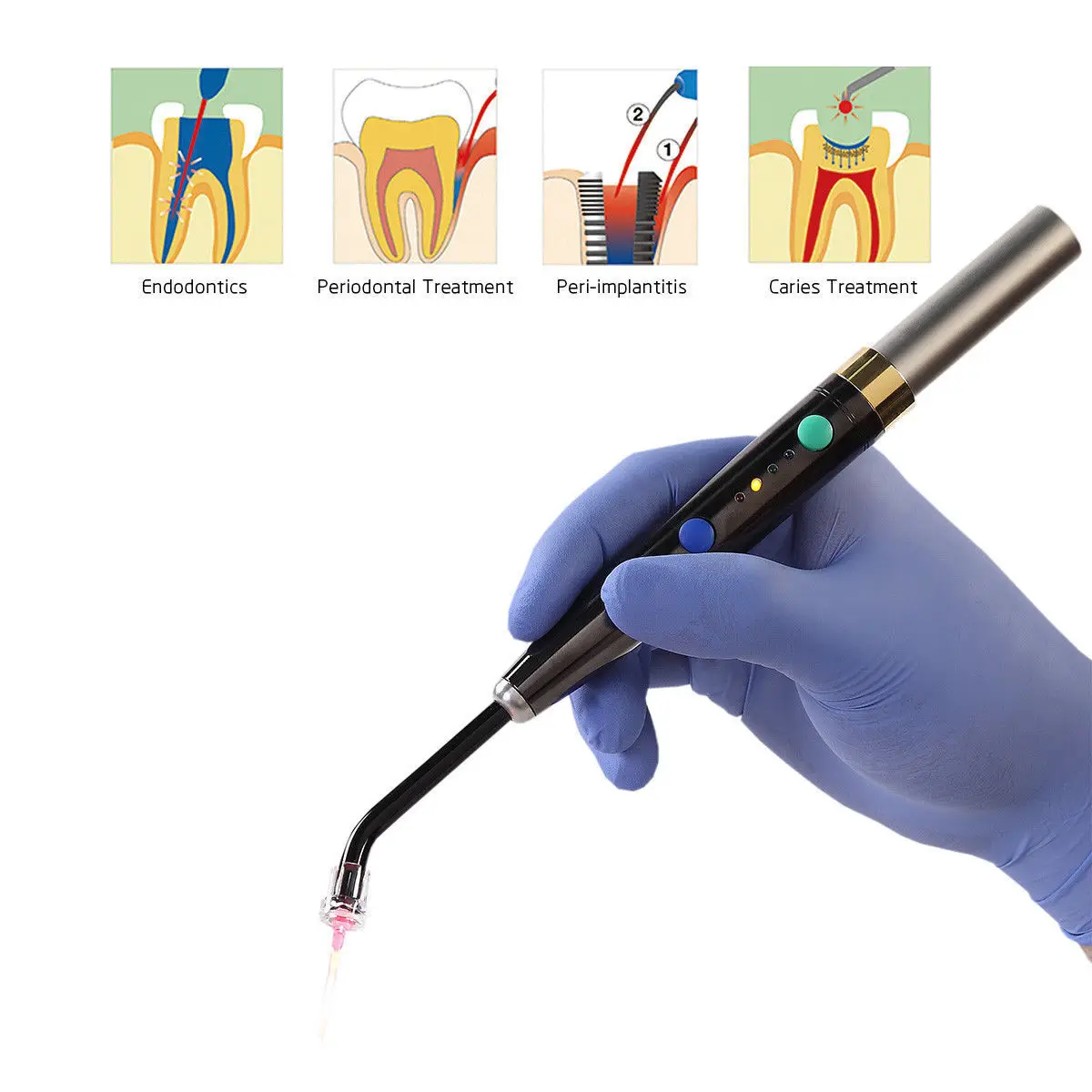 System dentystyczny Laser diodowy bezprzewodowy foto-aktywowany leczeniem pióro laserowe jamy ustnej do tkanek miękkich lampa Perio Endo chirurgiczna