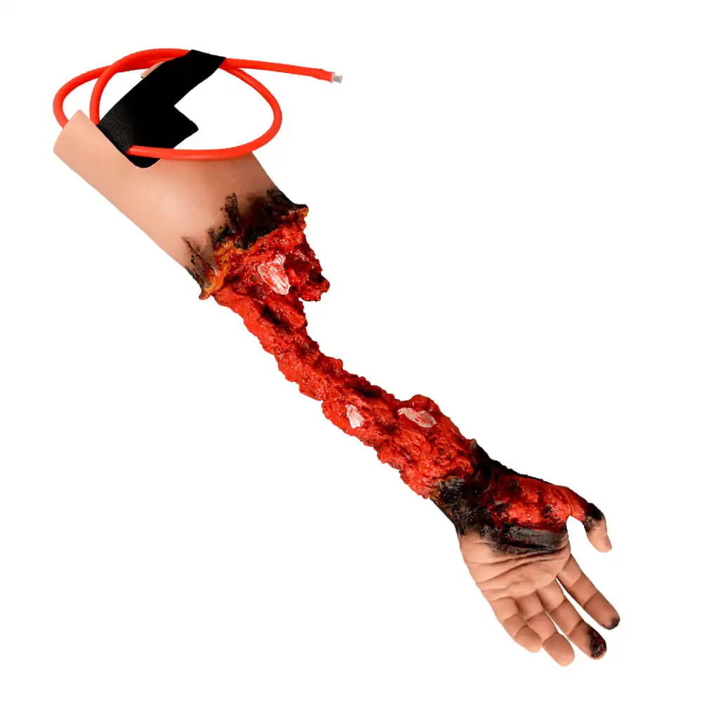 Ultrassist Partial Arm Amputation Wound Simulator Left Wearable Realistic Trauma Training for Medical Emergency Trauma Practice