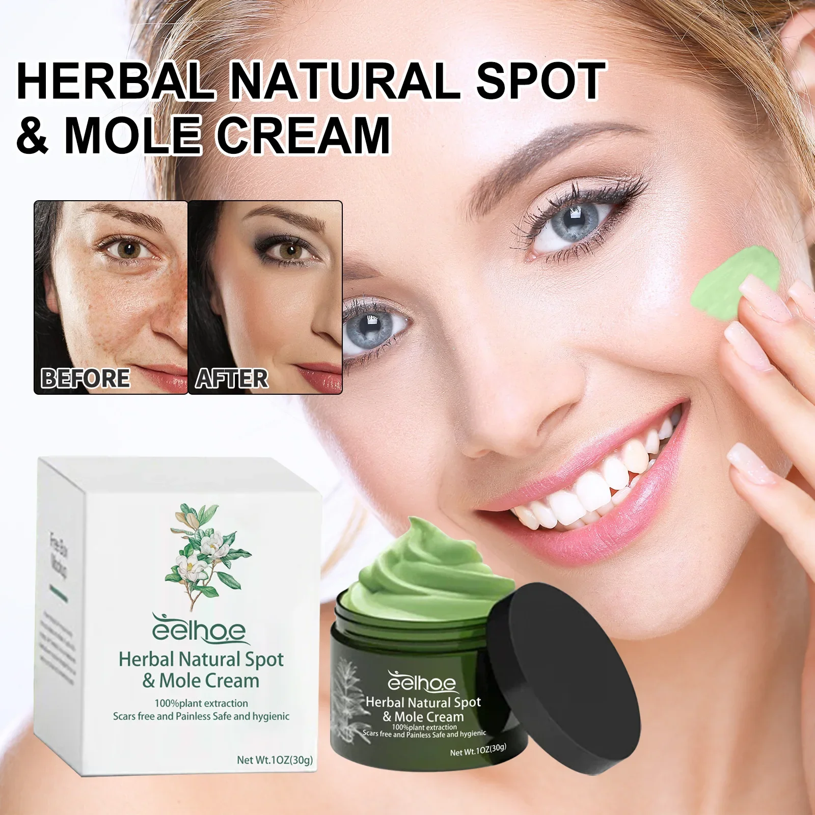 Eelhoe-Creme Natural Spot, Acne Desbotada, Reabastecimento Hidratante, Clareamento da Pele, Clareamento, Powerrepair, Beleza, 30g