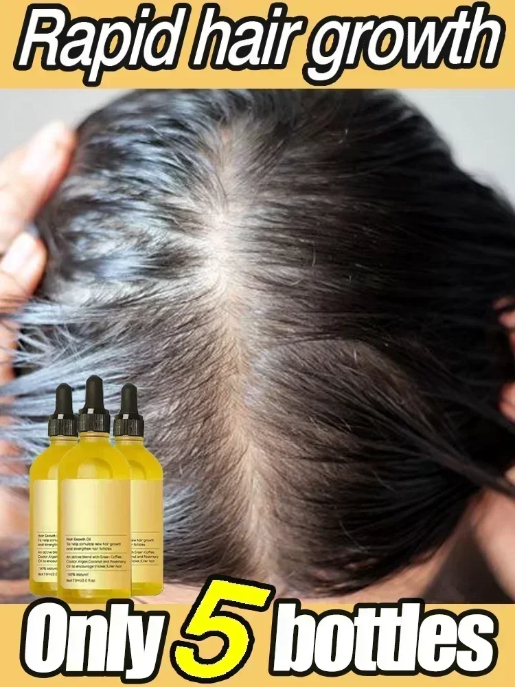 Óleo essencial para o crescimento do cabelo, eficiente anti calvície, perda de cabelo, nutritivo, reparo denso, cabelo danificado, hidratante, óleo suave