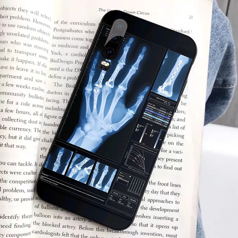 Radiological human organs Skeleton Phone Case For Huawei Honor 10 lite 9 20 7A 9X 30 50 60 70 pro plus Soft Silicone Cover