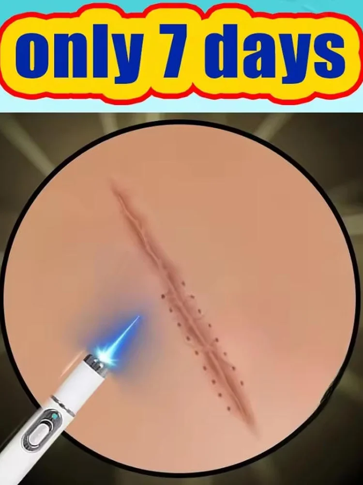 4th ᵍᵉⁿᵉʳᵃᵗⁱᵒⁿ ᵘᵖᵍʳᵃᵈᵉᵈ sᶜᵃʳ ⸴ ʳᵉpᵃⁱʳ sᶜᵃʳˢ ʳᵒoᵗ ⸴ ᑫᵘⁱᶜᵏˡʸ