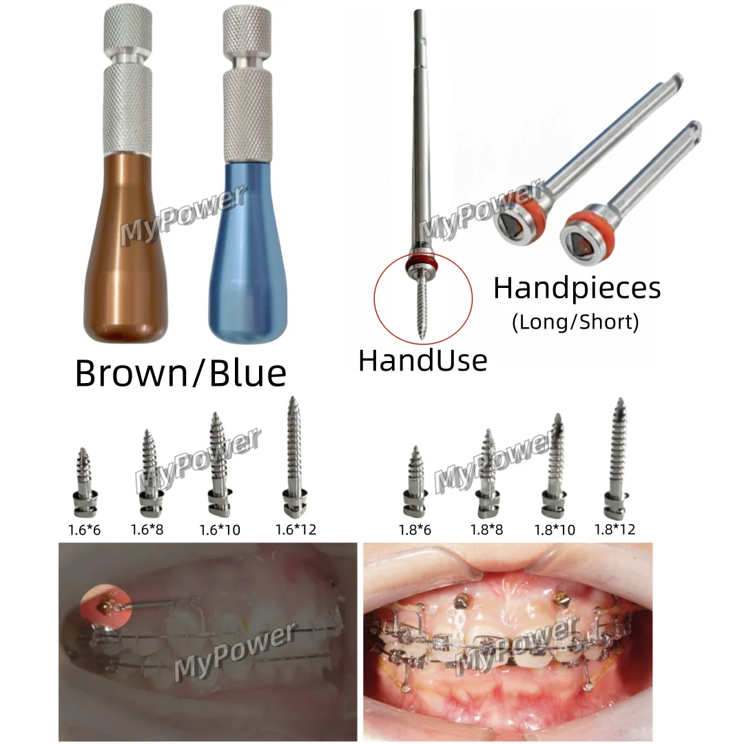 Temporary Anchorage Sytem Mandrel Triangle Inner Sleeve Implants Mini Screw Micro Screws Handpiece Key