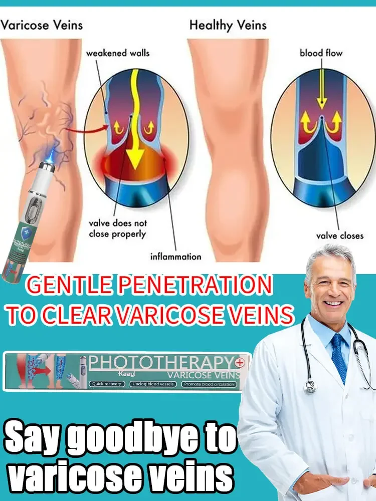 

Blue Light Laser | Varicose vein laser pointer | for Anyone with Sedentary or Standing