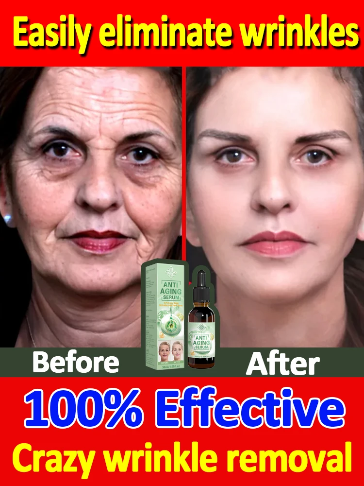 Wrinkles disappear, the first choice for beauty lovers