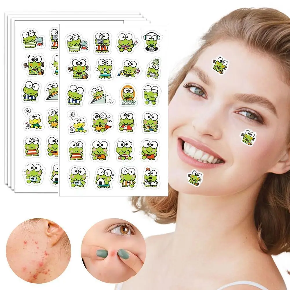 5 листов зеленая лягушка, 24 шт., лягушка с большими глазами, мультяшный пластырь от прыщей, полиэтилен нежный и не раздражающий, уменьшает прыщи