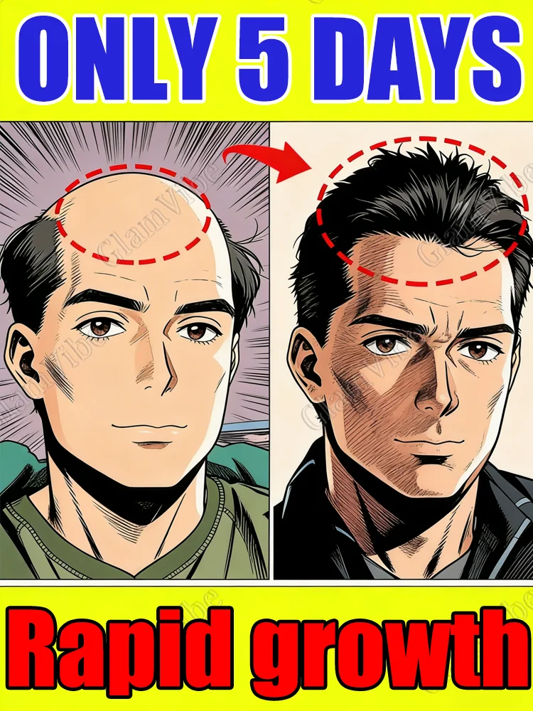 

ₜₕₑ ₙᵤₘᵦₑᵣ one selling hair growth product. Best hair follicle awakening spray