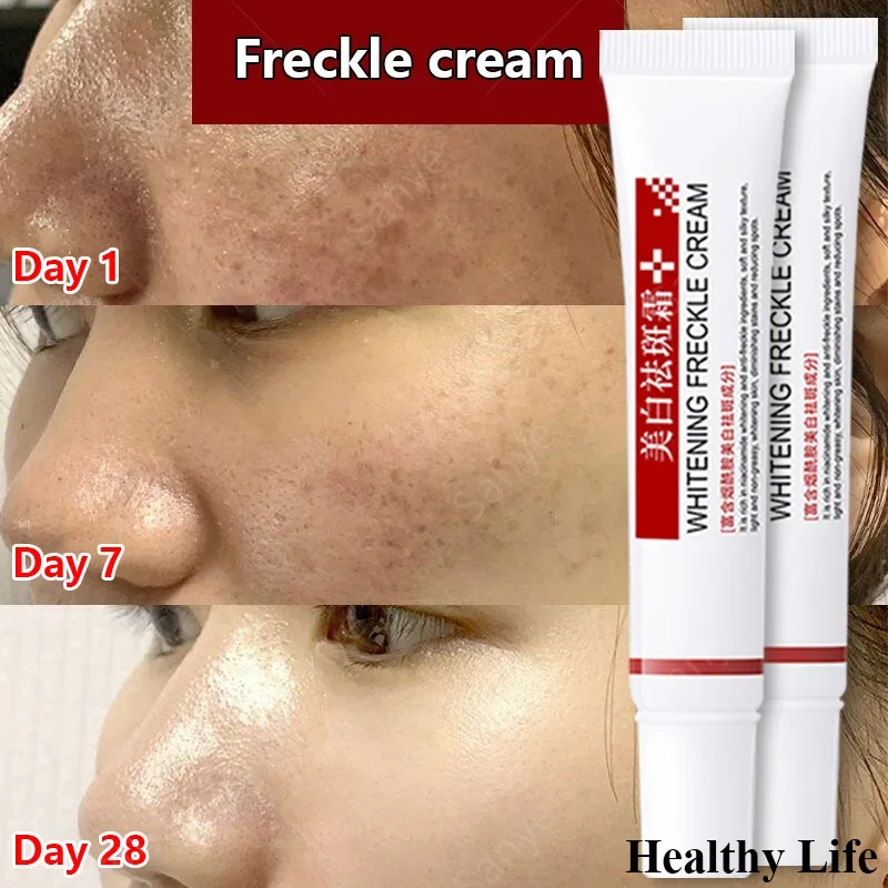 Whitening Face Cream Fade Fine Line Remove Dark Spots Freckle Firming Shrink Pore Moisturizing Brighten Melasma Facial Skin Care