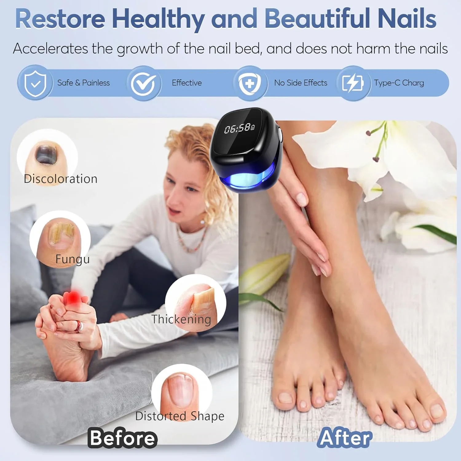 Home Use Nail Fungus Laser Machine Dual Light Wavelength Fungal Nail Treatment Foot Toenail Recovery Care Instrument