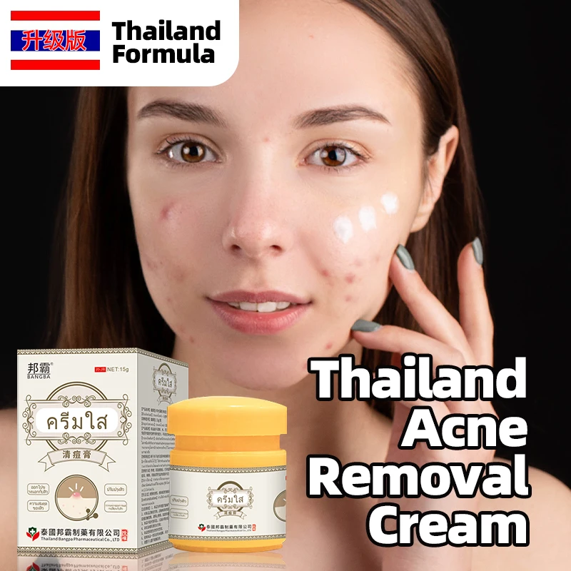 

Acne Treatment Cream Pimple Blackhead Remover Anti Acne Marks Removal Ointment Shrink Pores Whitening Face Care Thailand Formula