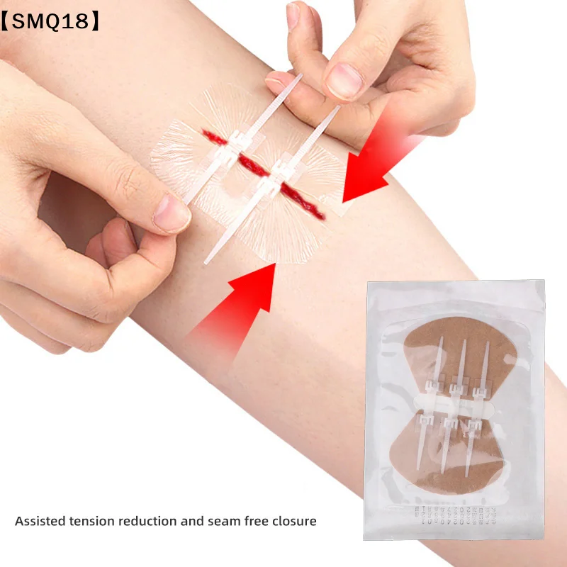 Zipper Band-aid Painless Wound Closure Device Suture-free Wound Dressing Patches Zip Suture Reducer Band Aid【SMQ】