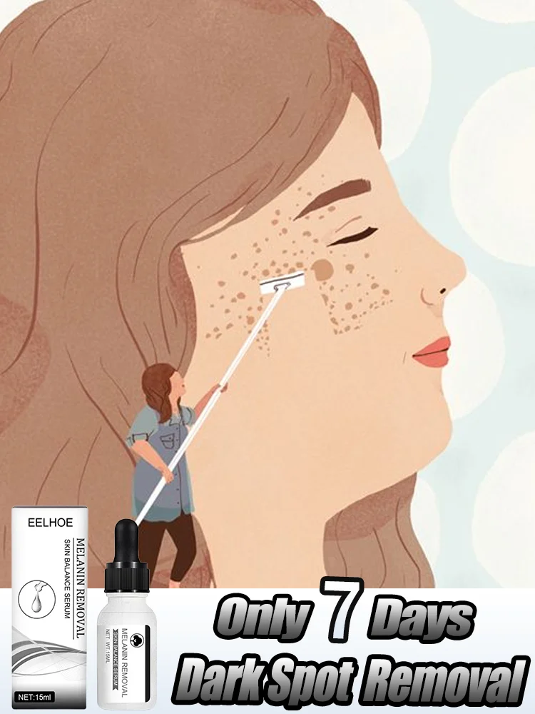 

Niacinamide Dark Spots Remover Serum Freckle Whitening Moisture Removal Black Dot Melasma Chloasma Face Skin Care Cream