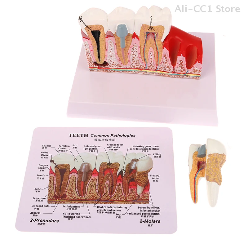 Standard Dental Oral Teeth Anatomical Teaching Model Comprehensive Tooth Structure Model Dentist Dental Student Demonstration