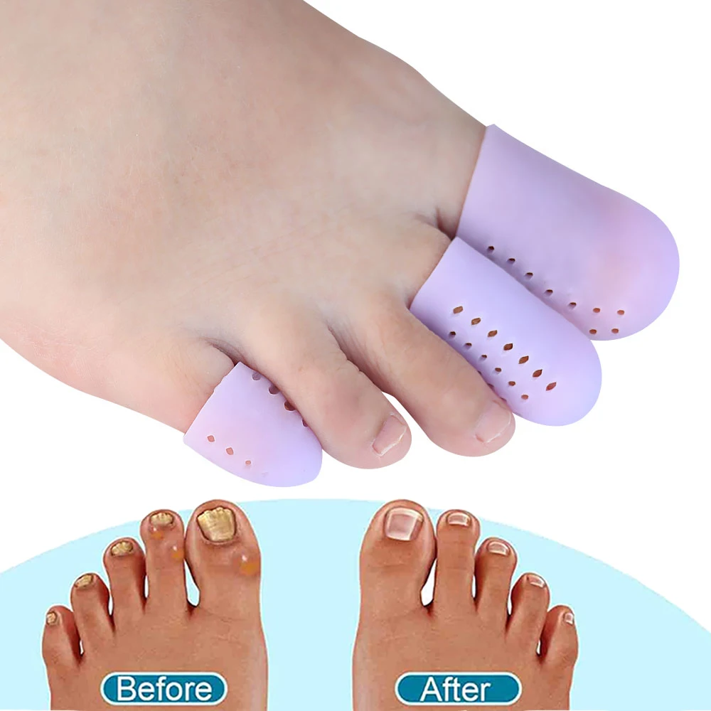 Pexmen 2Pcs Upgrade Gel Toe Protector Silicone Toe Caps Sleeves Prevent Pain for Corns Blisters and Missing or Ingrown Toenails