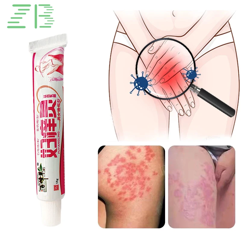 18g ZB Women Vaginal Tighten Gynecological Trichomonas Cream Female Sex Health Uterus Nursing Care Anti Itching Inflammation