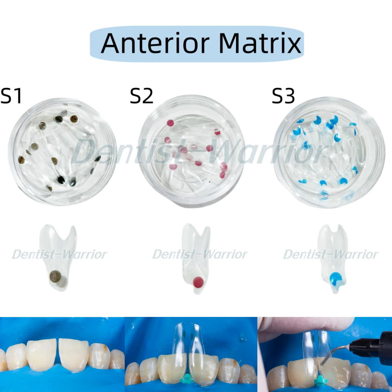 S1-S3 Dental Clear Matrix Anterior Restorative BT Bow Matrices Fit BioClear