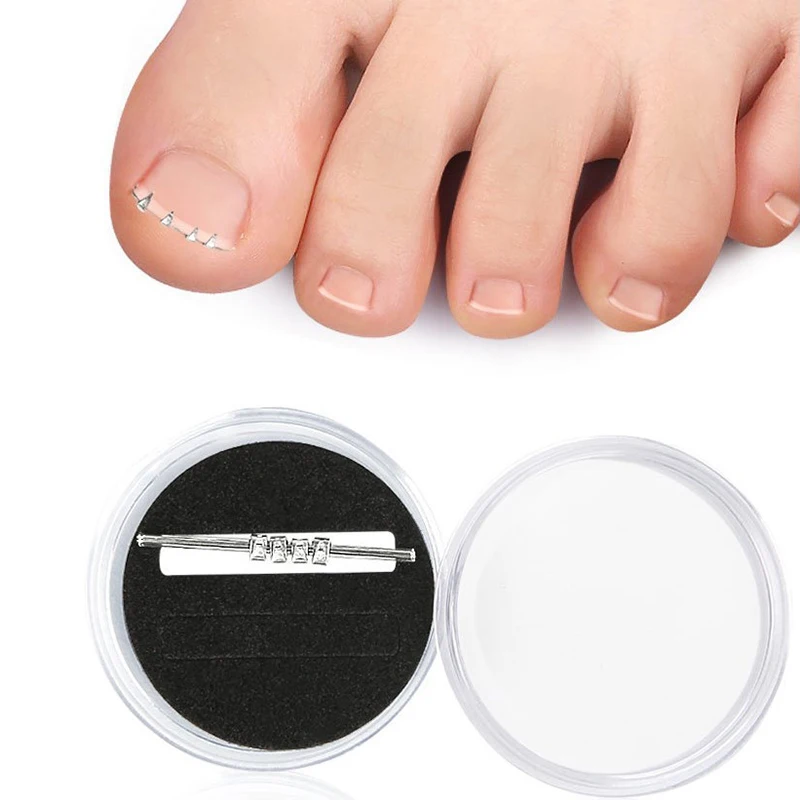 【1PCS Ingrown Toenail Correction Tool Invisible Ingrown Toe Nail Elastic Straightening Clip Brace Pedicure Tool】