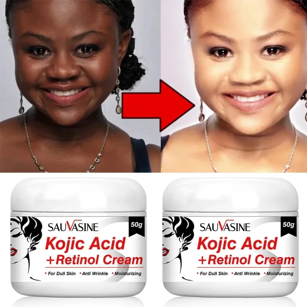 

New Remove Pigment Melanin Kojic Acid Cream Whitening Resurfacing Fade Moisturizing Cream Remove Dark Spots Face Cream Facial