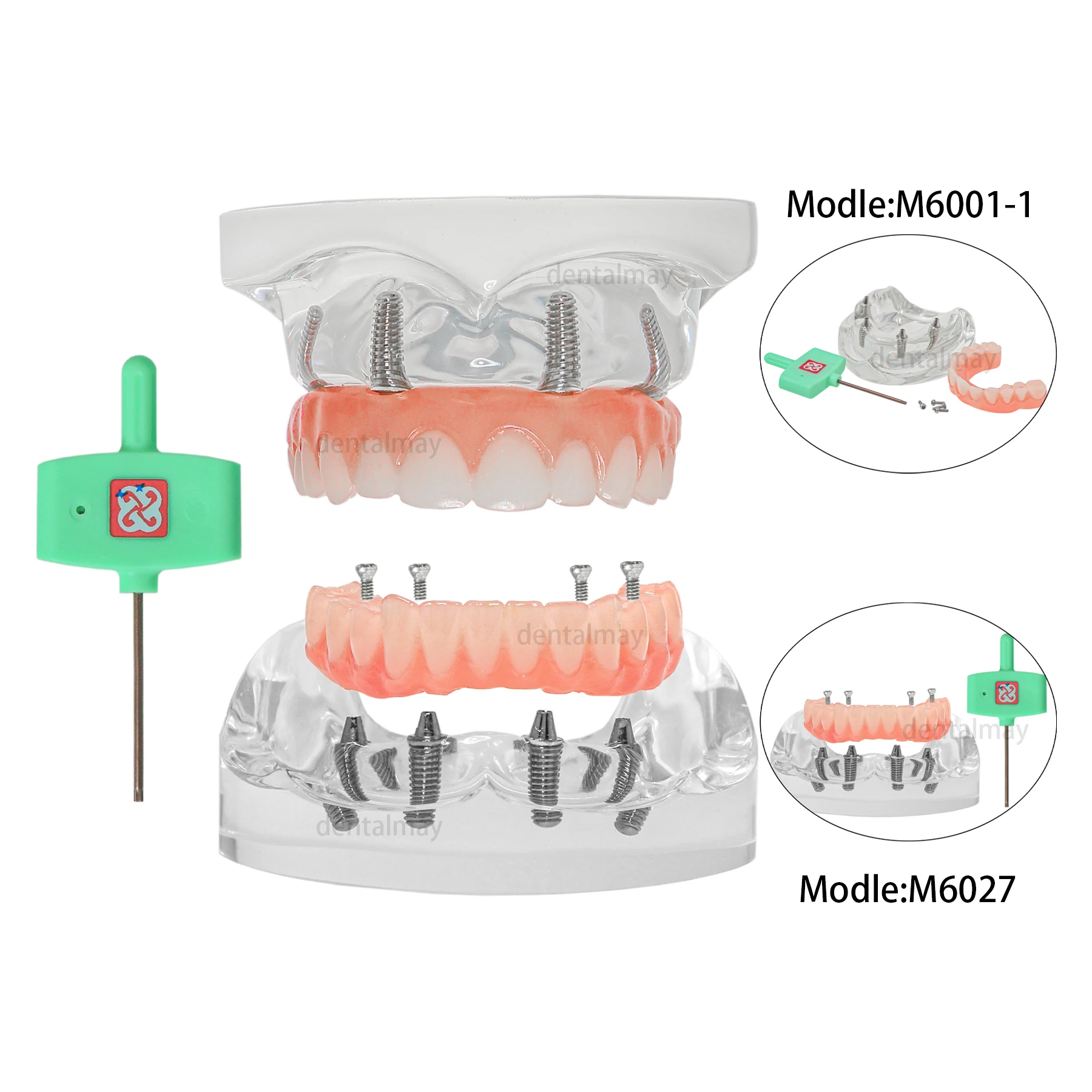 

Dental Overdenture Implant Model All-on-4 With 4 Screw Upper/Lower Clear Jaw