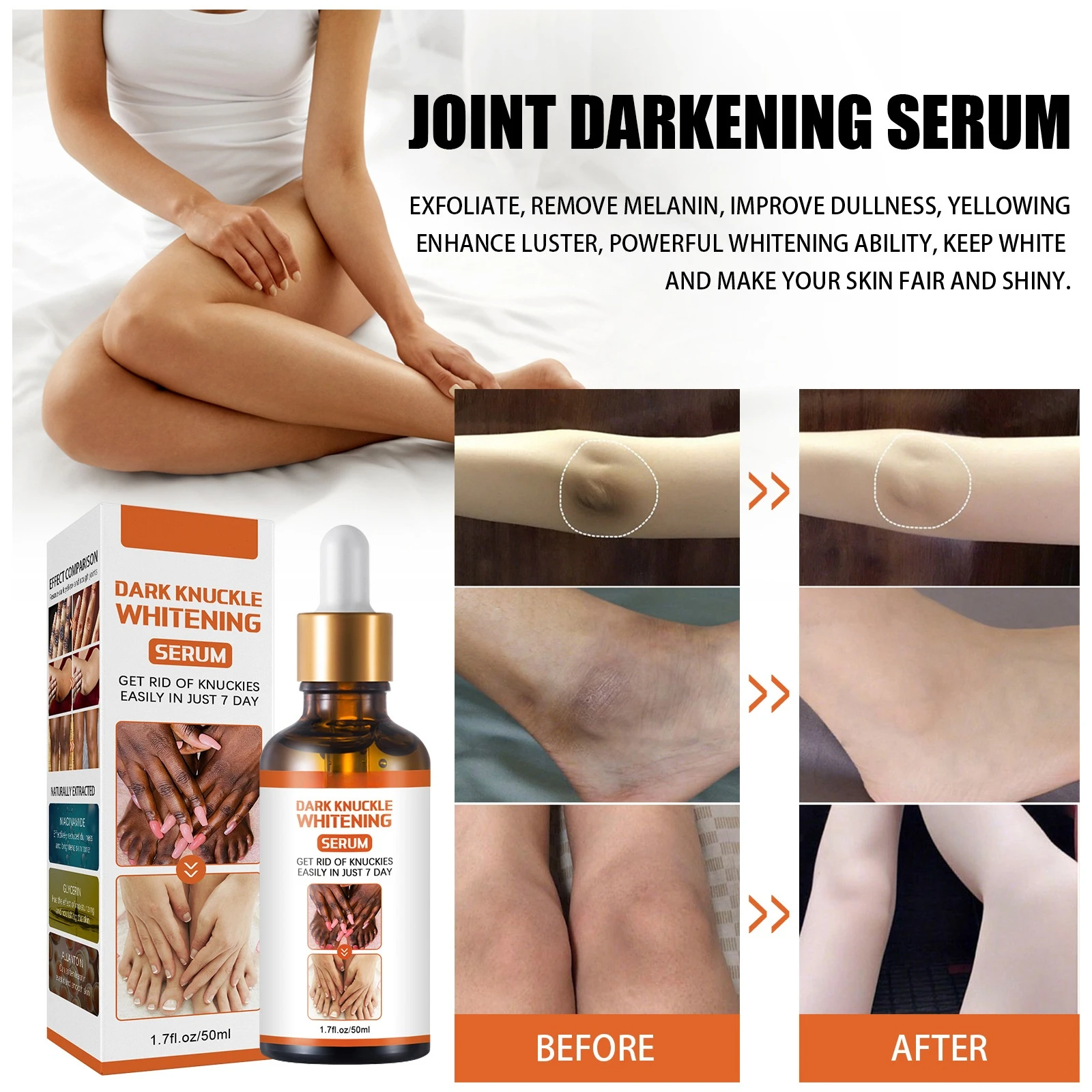 Beauty Serum Brightens Skin Tone Lighten Knees Finger Joints Ankle Corners Black Stain Removal Serotonin Moisturizing Skin Care