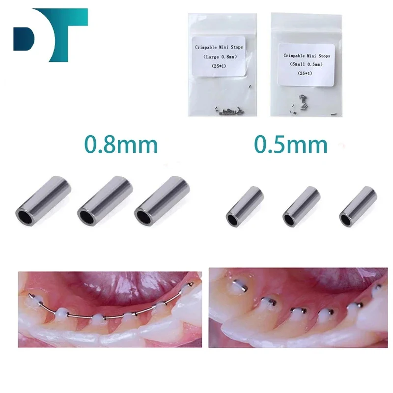 Dental Orthodontic Crimpable Hooks Mini Stops 0.5mm 0.8mm Stop Tube Dentistry Ortodoncia Acc 10pcs/Bag