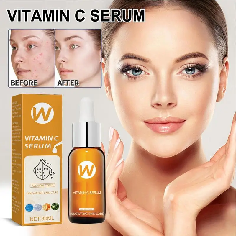 

Vitamin C Serums for Face | Black Spot Remover | 30ML Age Spots and Black Spot Corrector Skin Care Serums Effects Brightens