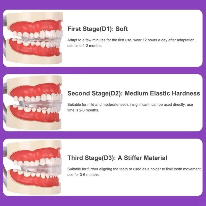 23GF 치열 교정 브레이스 치과기구 인스턴스 미소 치아 스트레이트너