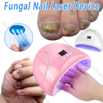 Dispositivo láser para uñas con hongos, reparación rápida de hongos en las uñas, reparación de onicomicosis, eliminación de hongos en las uñas, dispositivo para el cuidado de los pies