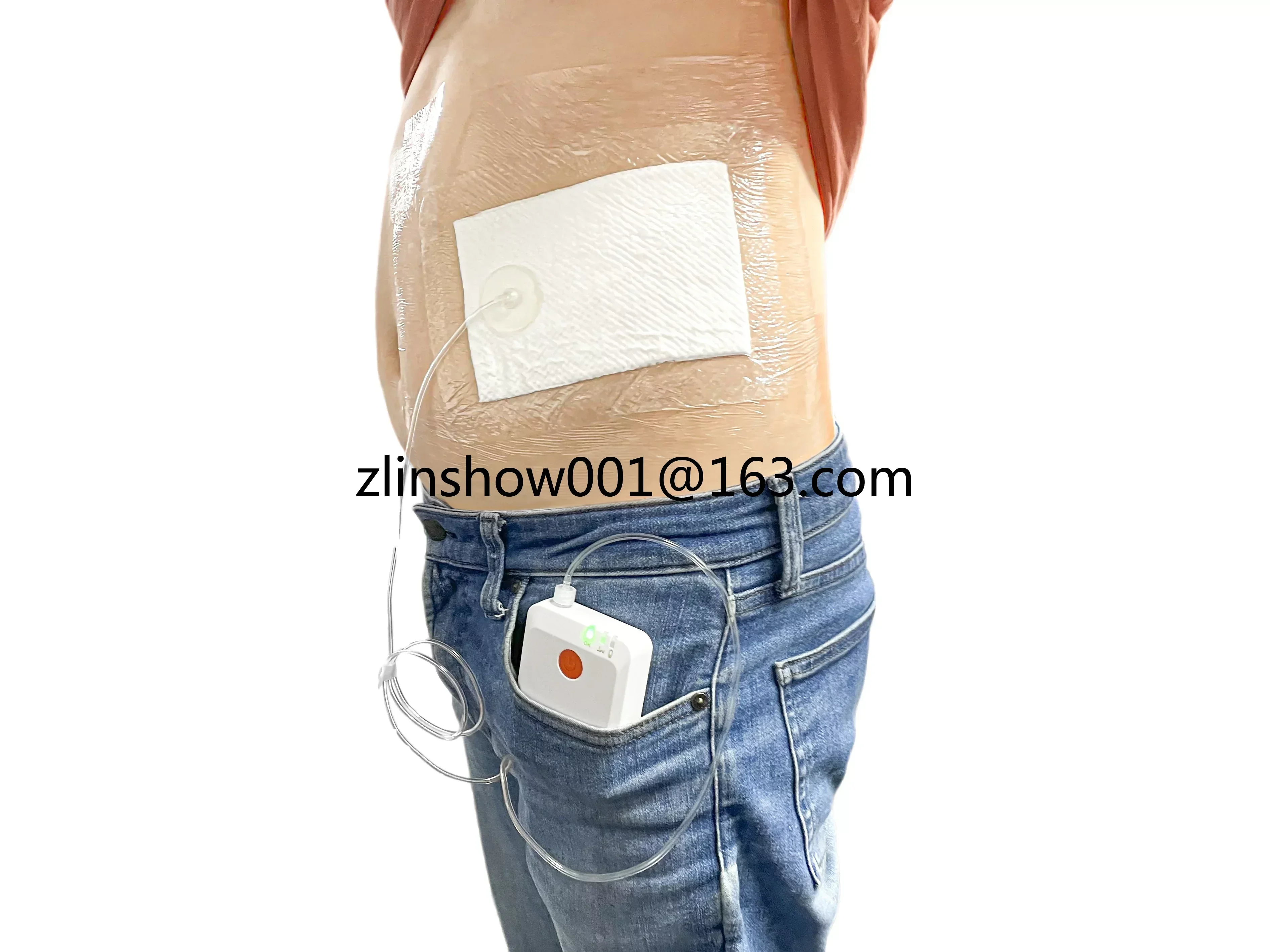 Imagem -05 - Npwt Pressão Negativa Ferida Terapia Kit Molho Médico Pcs