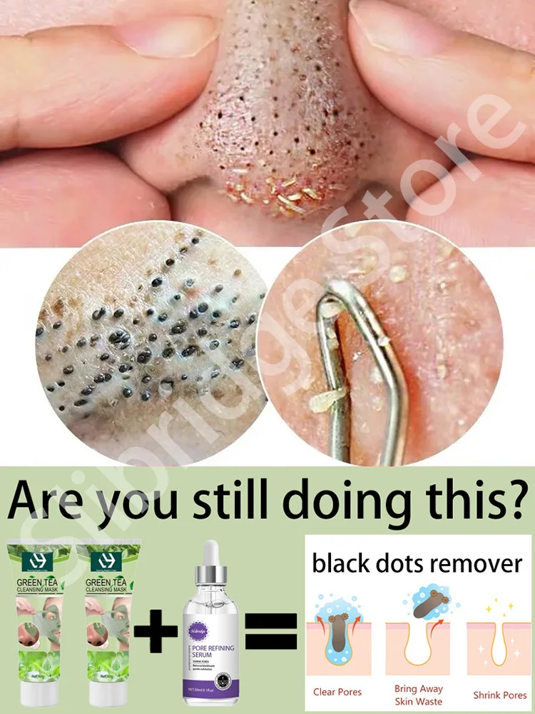 

Black Dot Remover Black Point Mask Face Pore Cleaning Blackhead Remover Black Dots Mask Pore Remover From Black Dots On The Nose