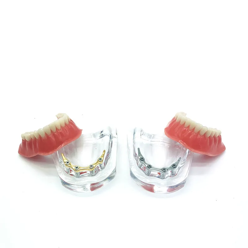 

Repair Teeth Implant Model Dental Study Teaching Model Denture Teeth Mandibular Model Golden Bar/Silver Bar Dental Materials