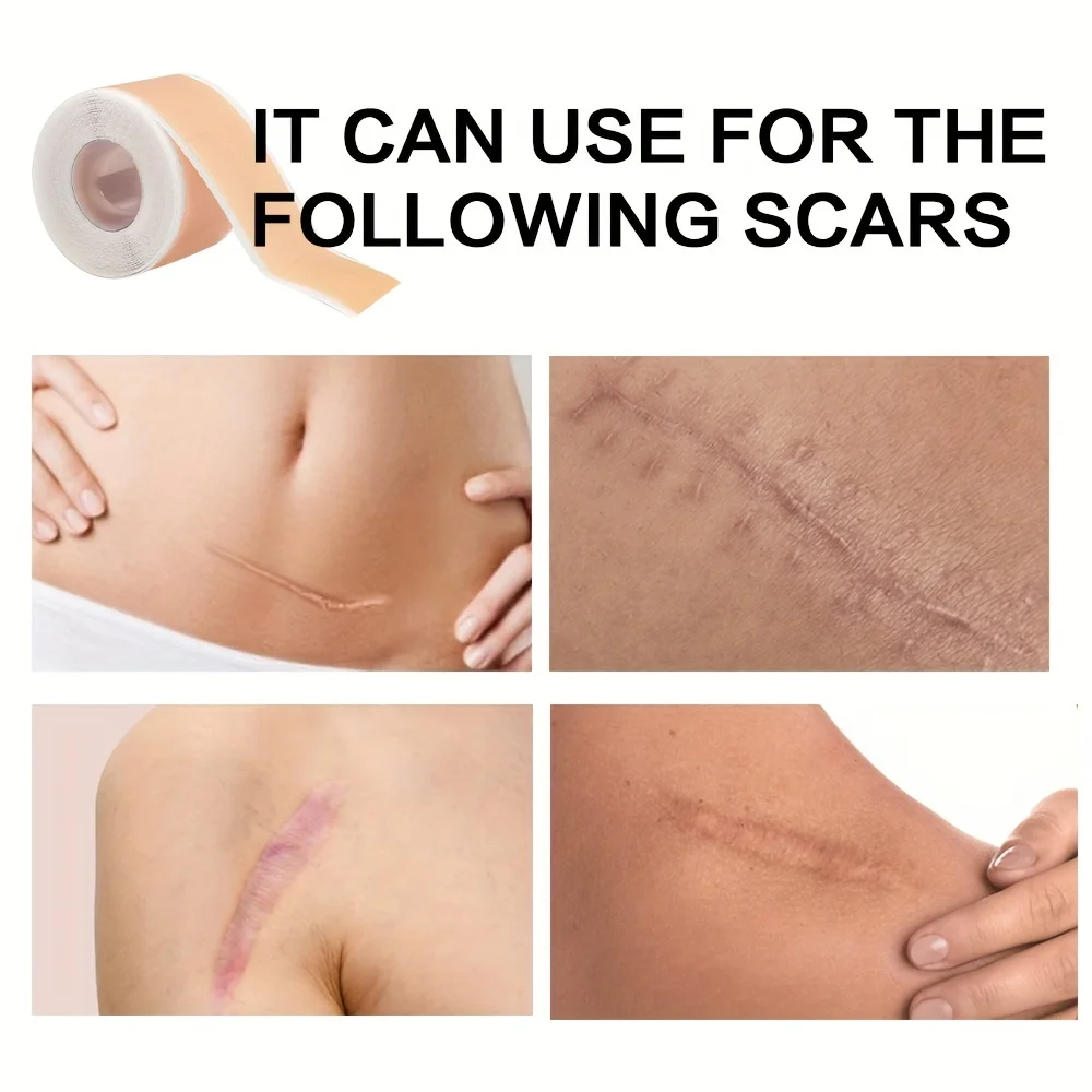 Narbenabdeckungspflaster, unsichtbares Silikonpflaster, Hautpflege-Abdeckpflaster 150 cm (59,1 Zoll)