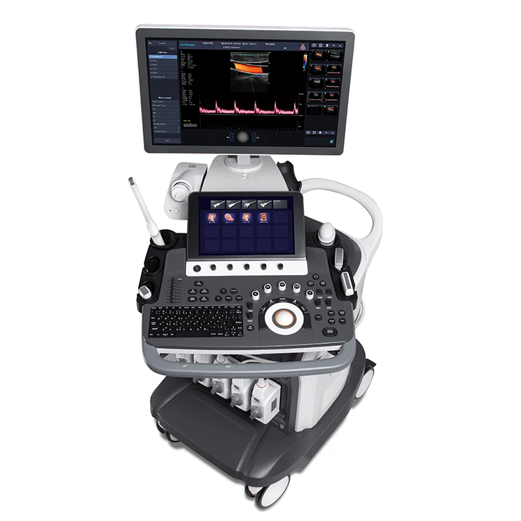 Sonoscape S50 Elite 4D Trolley Medical Ultrasound Equipment Color Doppler Ultrasound Machine