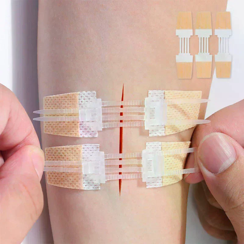Zipper Band Aid Painless Wound Closure Patch Suture Free Emergency Medical Plaster For Quick  First Aid Kits