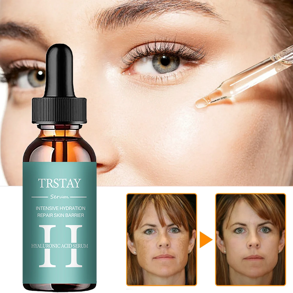 

hyaluronic acid essence reduces fine lines, tightens skin, and improves damaged skin