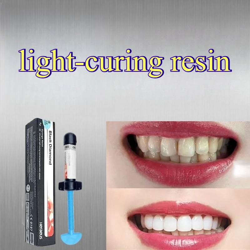 Teeth Whitening Restoration 9D Nano Teeth Carving Resin Material Light-curing Black Diamond OBM OBS Wear Resistant Anti Yellowin