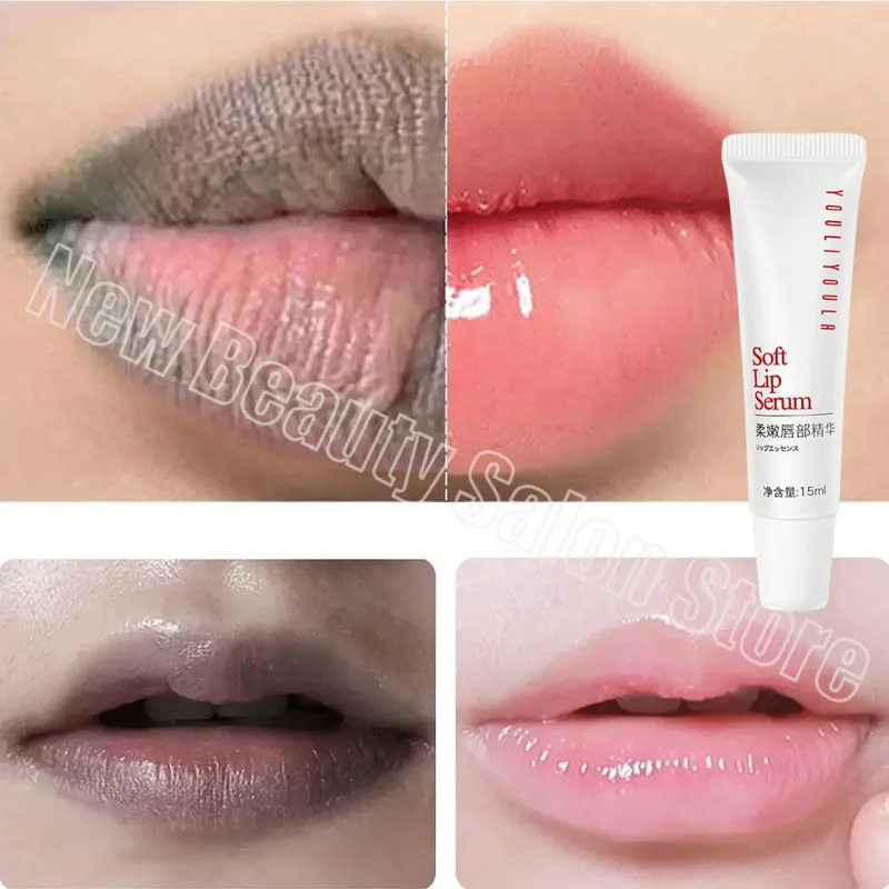 Entfernen dunkle Lippen Serum aufhellen Melanin Lippen maske Peeling verblassen Lippen linie abgestorbene Haut feuchtigkeit spendend aufhellen Reparatur Lippen pflege produkt