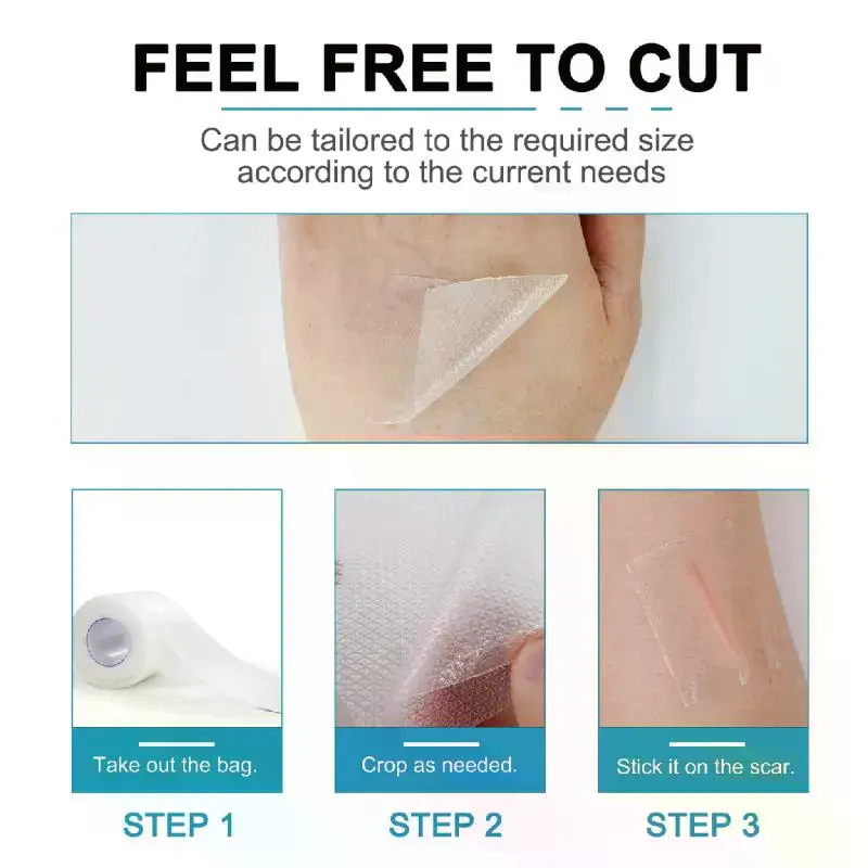 

1 рулон белой 1,5 м силиконовой ленты для удаления шрамов для хирургических шрамов, медицинский лист шрамов, безболезненная лента для ремонта шрамов, эффективная