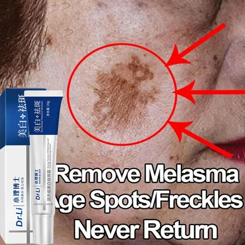 Freckle Whitening Cream Remove Melasma Dark Spots Fade Dark Spot Pigmentation Moisturize Brighten Face Korean Skin Care Product