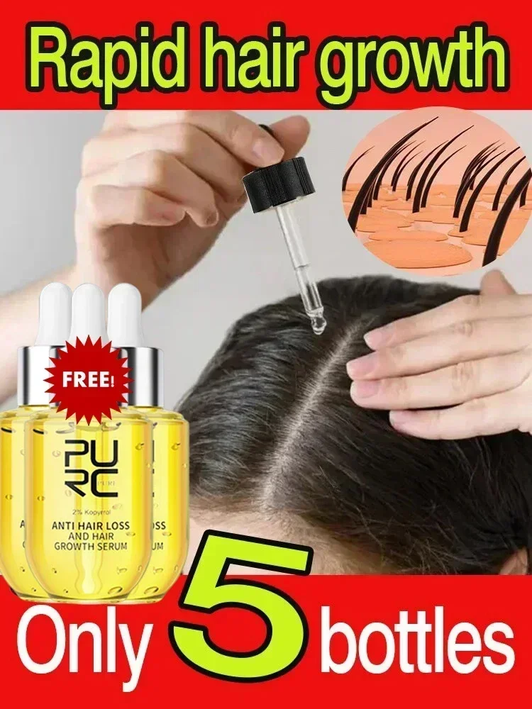 Fast Hair Growth for Men Women Ginger Grow Hair Oil Care Anti Hair Loss Scalp Treatment Serum Products Beauty Health 2023