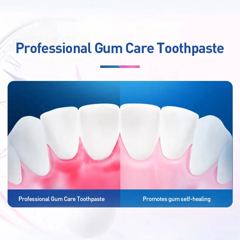 Oral-B Gum Care Fluoride Toothpaste 140g Mint Flavor Amino Acid Formula Relieve Gum Bleeding Redness Swelling Plaque Removal
