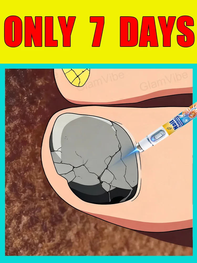 

2025 upgraded version of the second generation tool blue light laser nail repair