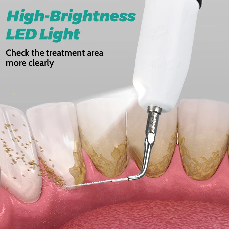 den tal Endo Activator With LED Light Sonic Irrigator Tips for den tal Instrument Root Canal Sonic Irrigator Endodontic Tools